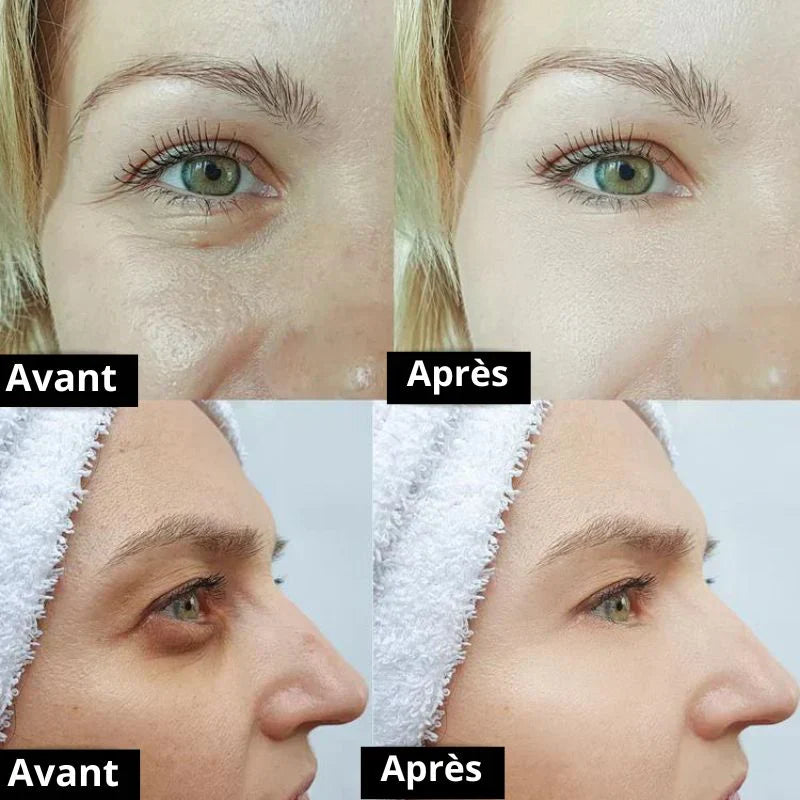 Licyana avis : mon test sincère de la Crème Anti-Cernes et Rides Instantanée