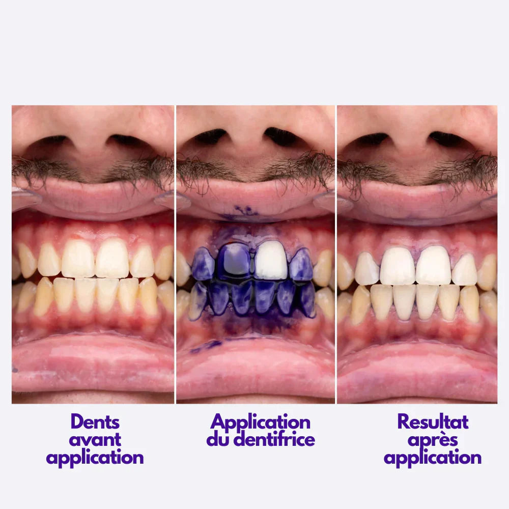 Glory Smile avis : le secret du dentifrice violet V34