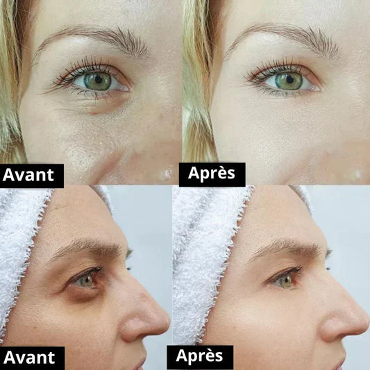 Licyana avis 2026 : mon test sincère de la Crème Anti-Cernes et Rides Instantanée