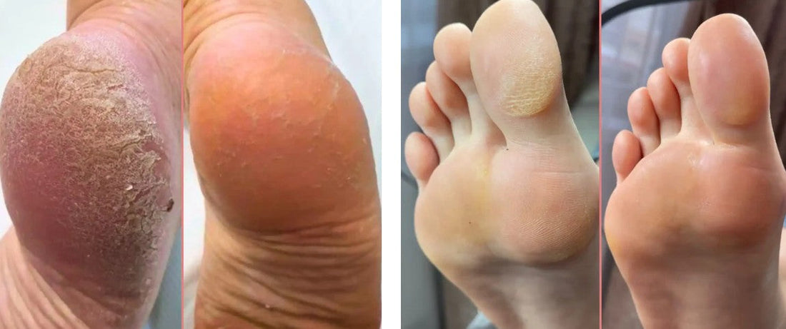 Mielle Glow avis : HoneyGlow est-elle fiable pour des pieds plus doux ?