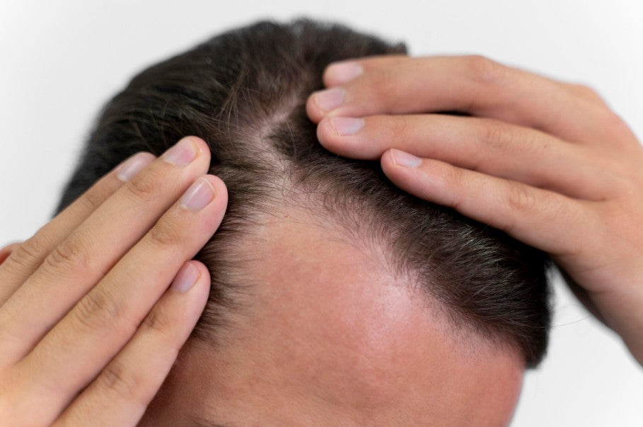 Miraj men avis : la tendance des crèmes capillaires densifiantes