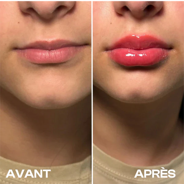 Supreme Lips avis : le repulpeur de lèvres chic qui réveille le sourire (sans bistouri)