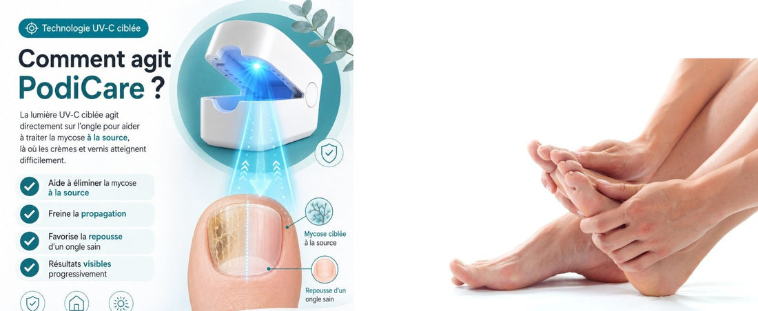 Orthovital avis : la tendance derrière l'appareil anti-mycose qu'on voit partout