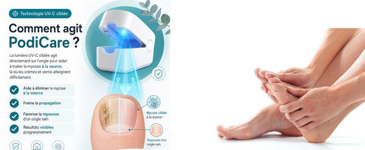 Orthovital avis : la tendance derrière l'appareil anti-mycose qu'on voit partout