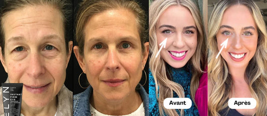 RoveaSkin avis : la crème regard “effet frais” qui promet beaucoup… et divise vraiment