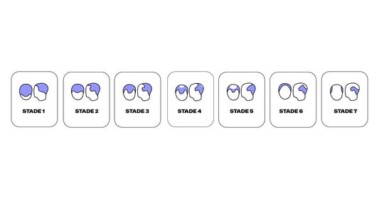 Hairdex avis : une SAS marseillaise qui publie tout de son identité, un hébergement certifié données de santé, et du finastéride au bout du questionnaire