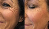 Avis cliente sur le Celimax Retinal Shot
